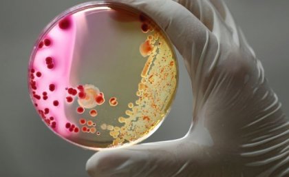 A gloved hand holds a petrie dish with two different forms of bacteria - one white, the other pink with red dots.